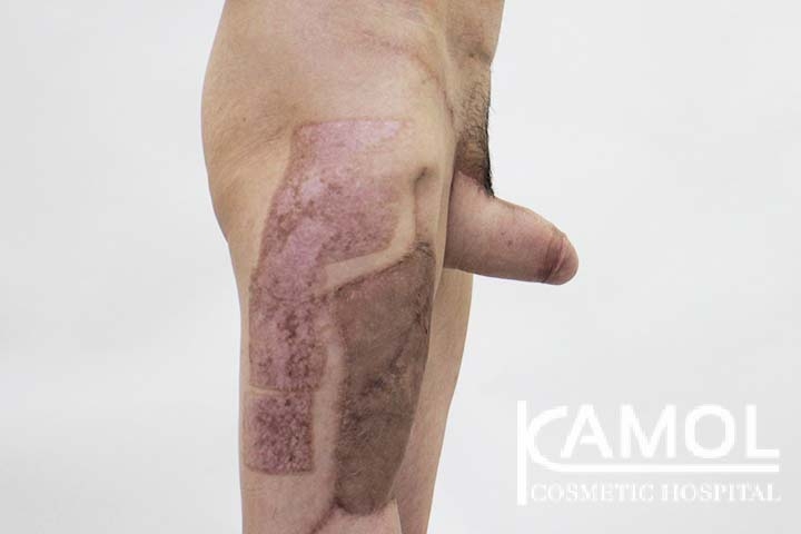 lg-65eecb762e352-image