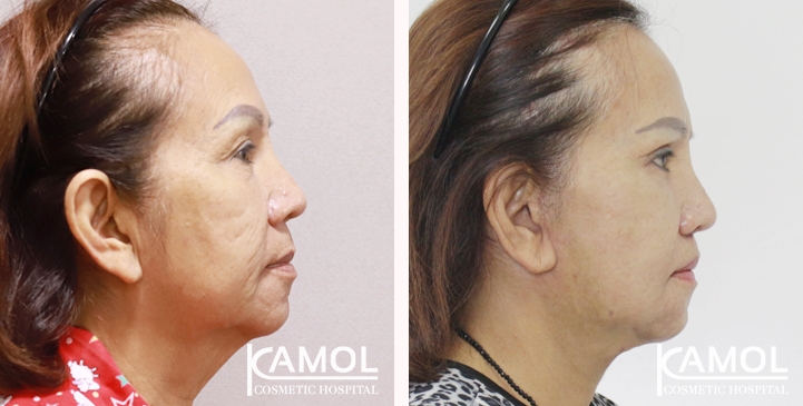 lg-6605274fa0d93-image