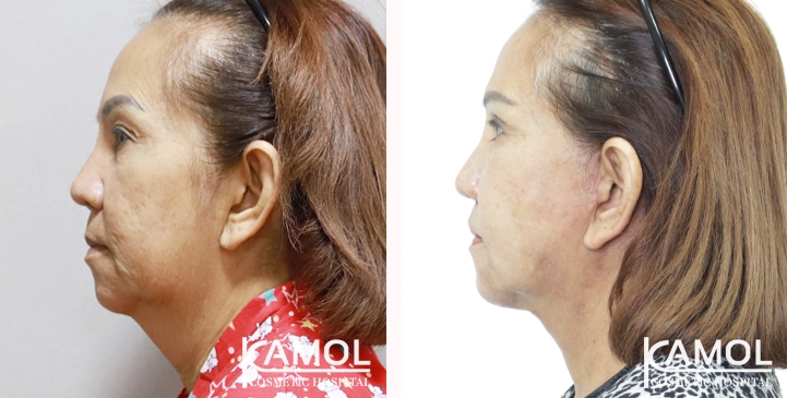 lg-6605274fc17dd-image