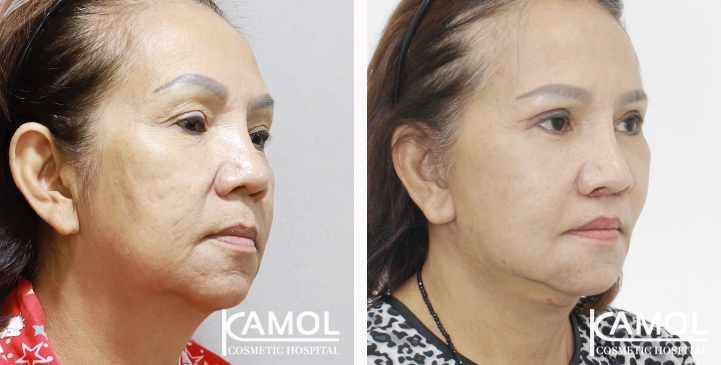 lg-6605274fe1676-image