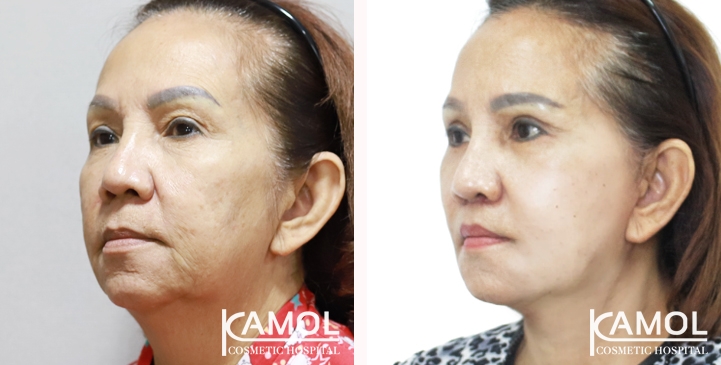 lg-660527500c35d-image