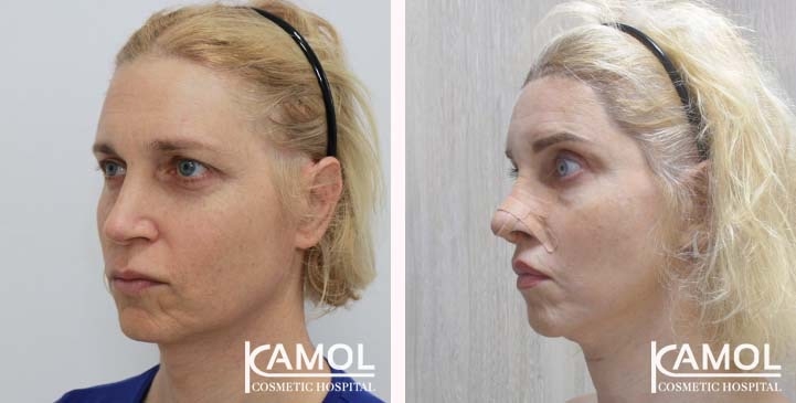 lg-663c57988c6b2-image