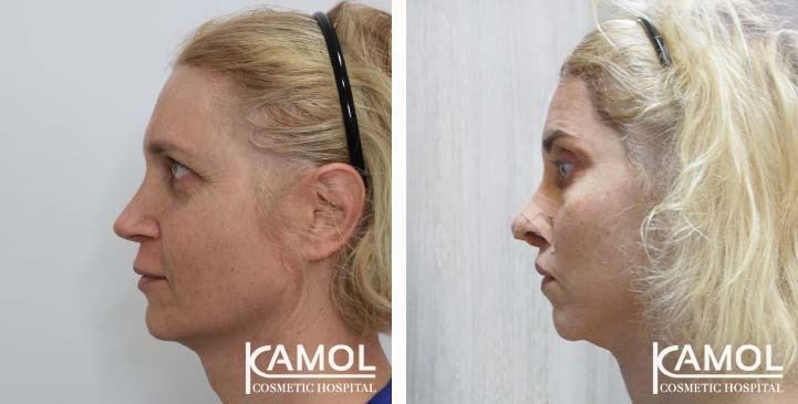 lg-663c57a2ee46f-image