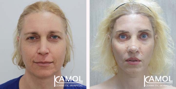 lg-663c580b78c91-image