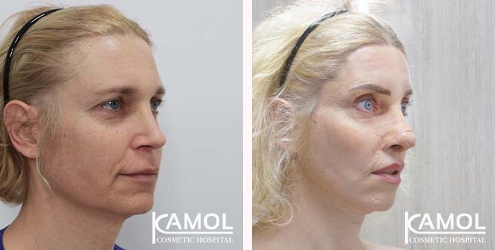 lg-663c5810d2a50-image