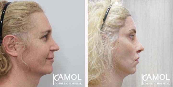 lg-663c5810f0e5e-image