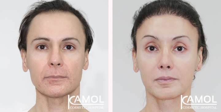 lg-6669930b70f9d-image