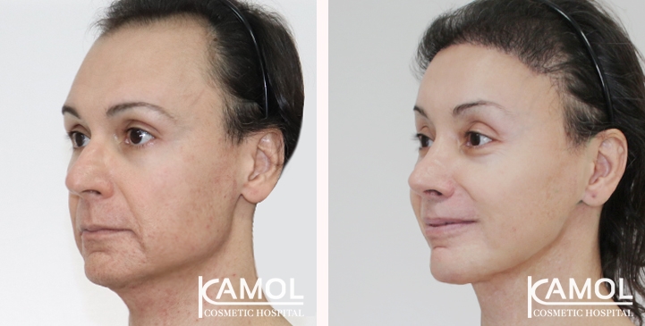 lg-666993112d4bb-image