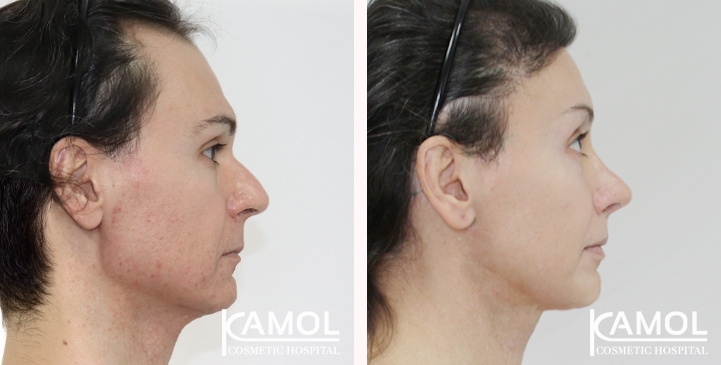 lg-66699316343b7-image