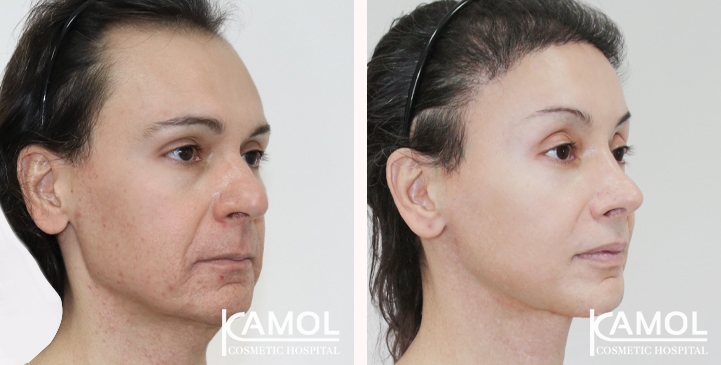 lg-66699318ebd2b-image