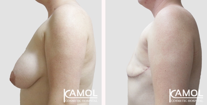 lg-66a5cf8d67145-image