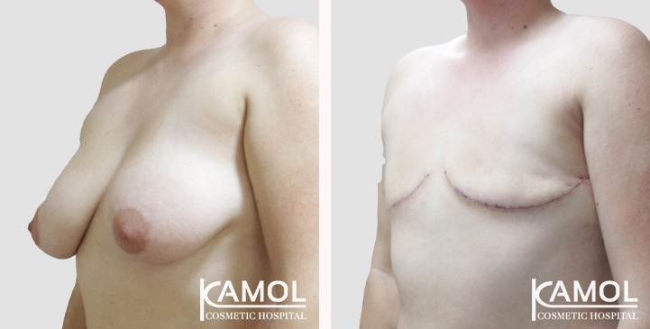 lg-66a5cf8d83fe4-image