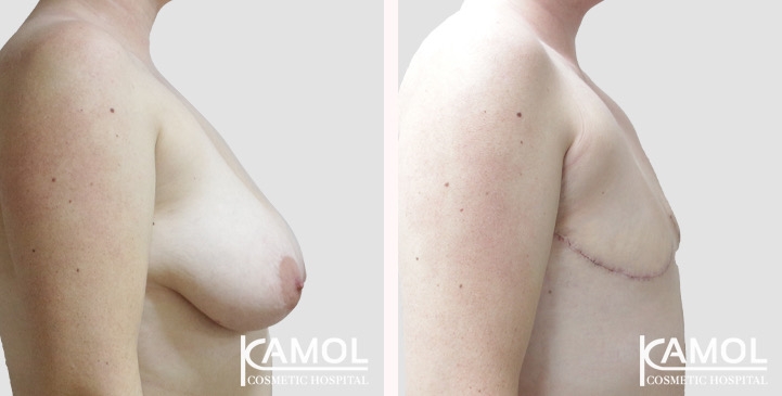 lg-66a5cf8da2754-image