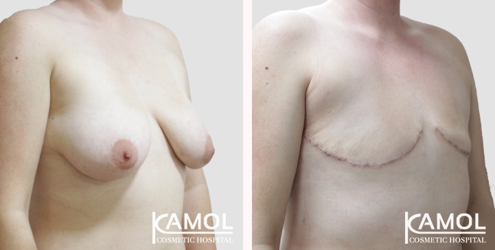 lg-66a5cf8dc38af-image