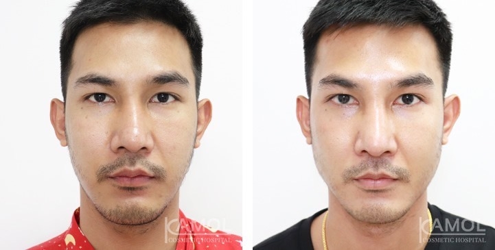 lg-672ae0c134af8-image