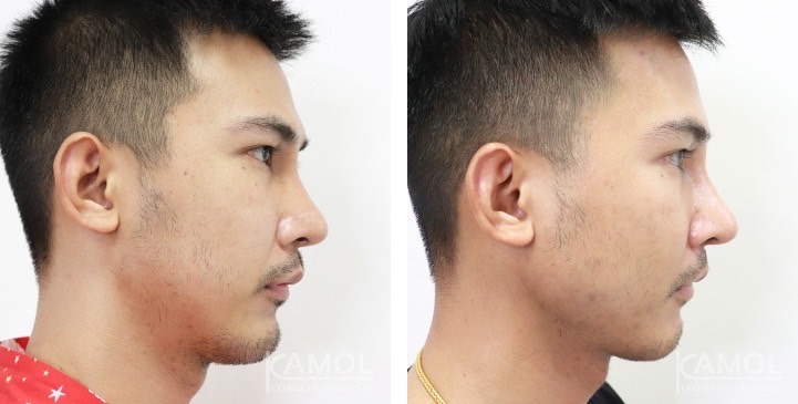 lg-672ae0c159e49-image