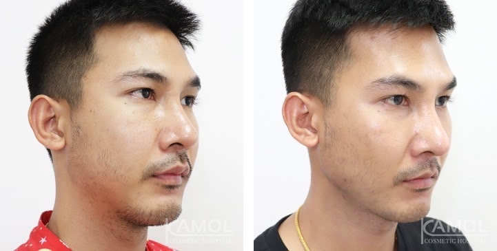 lg-672ae0c16c981-image