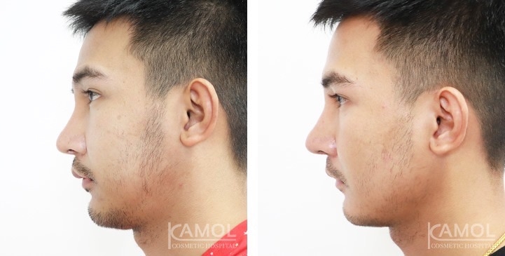 lg-672ae0c181264-image