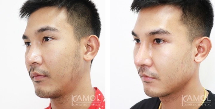 lg-672ae0c19acb6-image