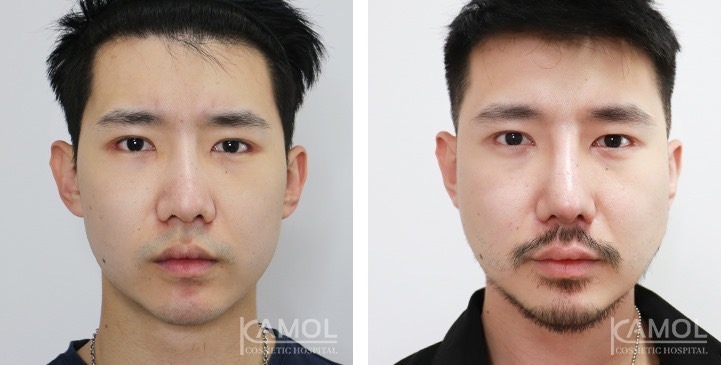 lg-672ae0e53219f-image