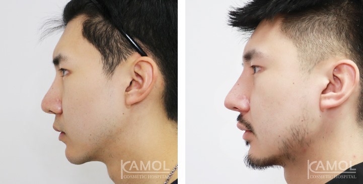 lg-672ae0e549040-image