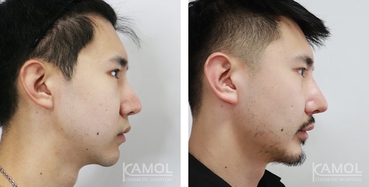 lg-672ae0e55d336-image