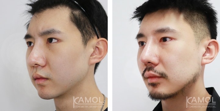 lg-672ae0e574f6b-image