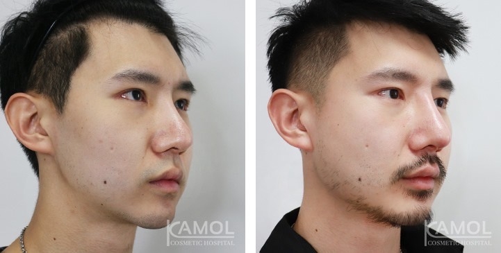 lg-672ae0e58fa69-image