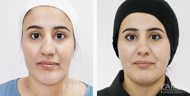 lg-6749dcd609bdc-image