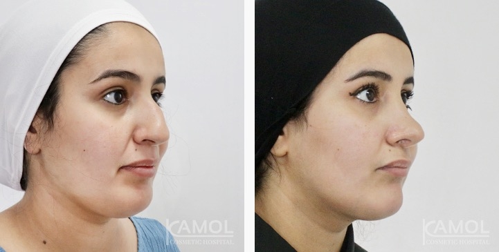 lg-6749dcda308eb-image