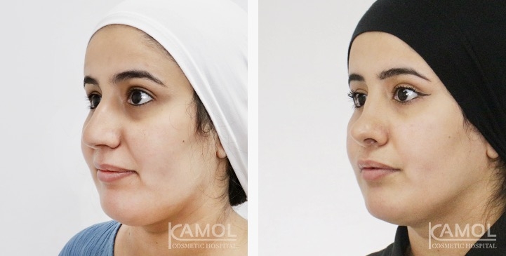 lg-6749dce54178b-image