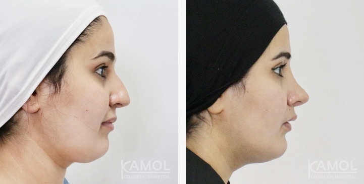 lg-6749dcece5c2a-image