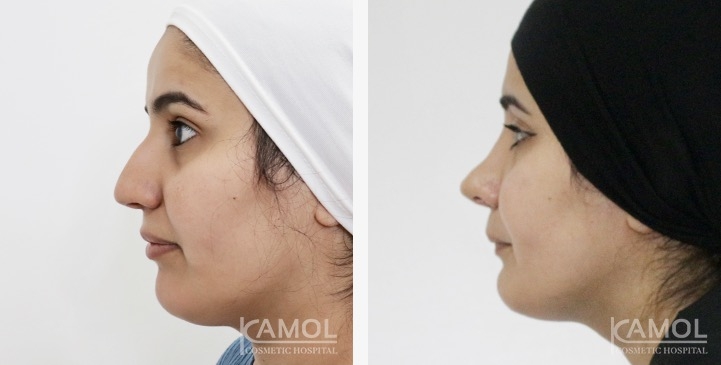 lg-6749dced0993f-image