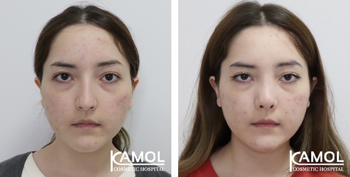 lg-67541e82ae2df-image