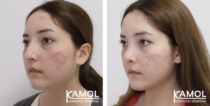 lg-67541e8385d18-image